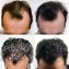 Массажер для головы против выпадения волос Gezatone Healthy System HS575 #5