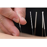 Акупунктурные позолоченные стерильные иглы 0,2х30 мм с направителем 100 игл в упаковке